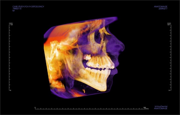 Mobile Cone Beam CT Scans